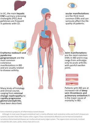 New pattern of individualized management of chronic diseases: focusing on inflammatory bowel diseases and looking to the future